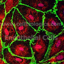 Primary Endothelial Cell Culture Protocol